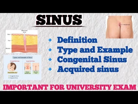 👉Sinus Explained Easily || Definition, Types & Examples with Diagram ||