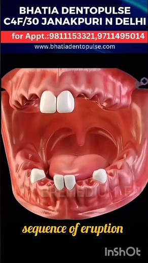 How do Teeth erupt in the mouth? #eruption #teeth #dentist