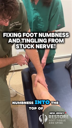 Foot numbness or tingling that just won’t go away? ⚡️ It may not actually be coming from your foot. In this treatment we’re working on a common peroneal nerve entrapment, where the nerve gets restricted by adhesion as it travels around the outside of the knee. When this nerve can’t glide properly, it can lead to numbness, tingling, burning, or weakness into the foot and lower leg. By removing the adhesion around the nerve, we help restore normal movement and reduce irritation so the nerve can fu