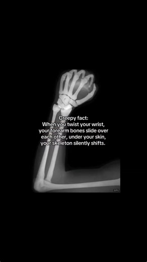 When you twist your wrist, your forearm bones slide over each other