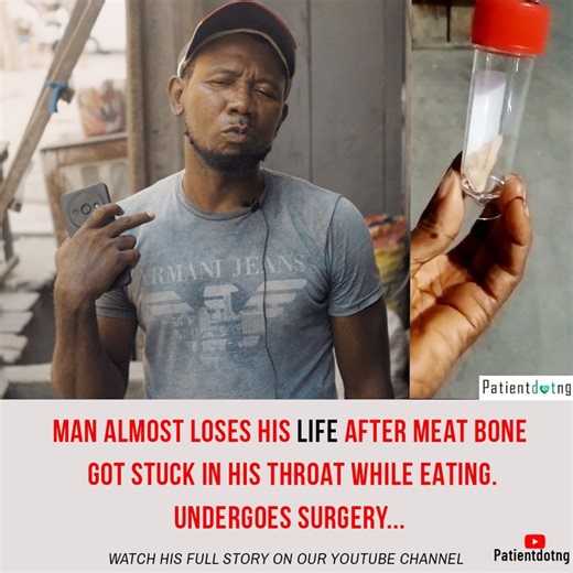 Man Chokes On Fish Bone And Almost Lost His Life, Undergoes Surgery. - Health - Nairaland