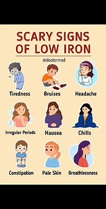 Scary Signs of Low Iron You Should NEVER Ignore! | Symptoms of Iron Deficiency Are you feeling tired all the time or noticing unusual bruises? � These could be scary signs of low iron! In this video, we’ll explain the most common symptoms of iron deficiency anemia — from fatigue and headaches to pale skin and breathlessness. Learn how to recognize early warning signs before it’s too late! �#IronDeficiency #LowIronSymptoms #AnemiaAwareness #HealthTips #DoctorMed #NutritionFacts #HealthyLiving #Fa