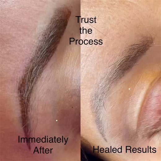 Don’t be afraid of sharpie brows. Find an artist who’s work you like. Ask to see pictures of HEALED results. If you still like what you see, book your appointment and trust your artist and the process. Nothing sets your eyes off more, than a beautiful set of brows. ##permanentmakeup #pmuartist #lipblush #ombrebrows #powderbrows #lushlips #lipblushing #permanentjewelry #permanenteyeliner #shadedeyeliner #bbglow #bbglowtreatment #nueconceal #scarcamouflage #stretchmarkcamouflage #skinrejuvenation 
