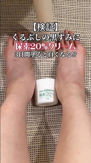 【3日間検証】くるぶしの黒ずみに尿素20%クリームを塗ると白くなる!? #スキンケア#尿素クリーム #黒ずみ #検証