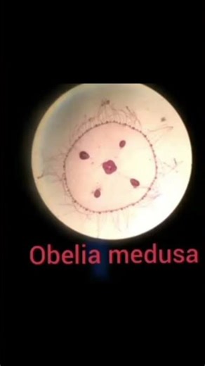 ##Obelia (Medusa)#MSC 1 semester##