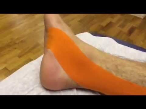 Tibialis Posterior KT Tape