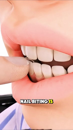 Understanding Nail Biting: Health Risks and Effects