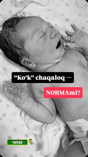 Dr. Zebiniso Raximova | Akusher-ginekolog • UZI on Instagram: "“Chaqaloq nega ko‘k tug‘iladi?” Bu kasallik emas. Bachadonda o‘pkalar ishlamaydi, kislorod kindik orqali keladi. Tug‘ilgach birinchi nafas bilan o‘pkalar yoziladi va qon aylanishi o‘zgaradi. Shuning uchun rang avval tanada, keyin qo‘l-oyoqlarda pushtilashadi. Qo‘l va oyoqlarning ko‘kimtirligi — akrotsianoz, 48 soatgacha norma. ⚠️ Xavfli qachon? Agar tana ko‘k qolsa, bola sust bo‘lsa, lab va til ko‘karsa. Buni avval bilarmidingiz? Ko‘
