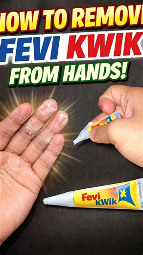 Remove Fevi Kwik from hands ? #shorts #experiment #how