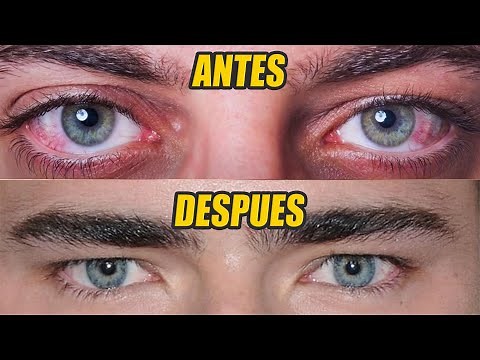 How to Have Attractive, Beautiful Eyes for Men | 5 Easy Ways
