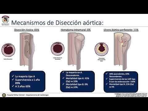 Disección aórtica en el servicio de urgencias // Síndrome aórtico agudo