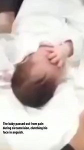 24K views · 203 reactions | #Circumcision is excruciatingly painful. It involves multiple tissue-damaging steps, including tearing, crushing, and slicing of a highly sensitive part of the body – often without adequate anesthesia – while the baby is restrained on a board. Babies have continuing pain during the healing period, when the wound is exposed to feces, urine, and irritation from the diaper. | Bloodstained Men & Their Friends | Facebook