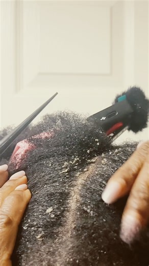 ASMR scalp deep cleaning #naturalhair #asmrscalp #scalpmassage #scalptreatment #dandruffcleaning