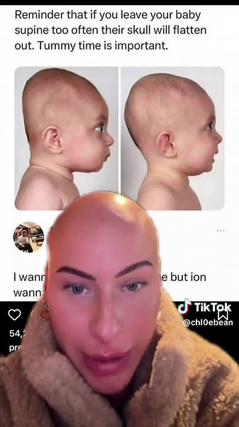 Importancia del tiempo de barriga para la cabeza de bebés