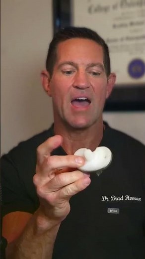 Total Knee Replacement Surgery Explained