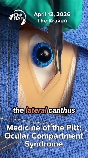 Medicine of the Pitt: Ocular Compartment Syndrome