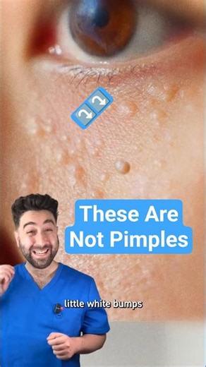 Don't Squeeze These White Bumps