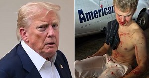 Trump Reveals Musk’s ‘Big Balls’ Was Beaten in Bloody Attack