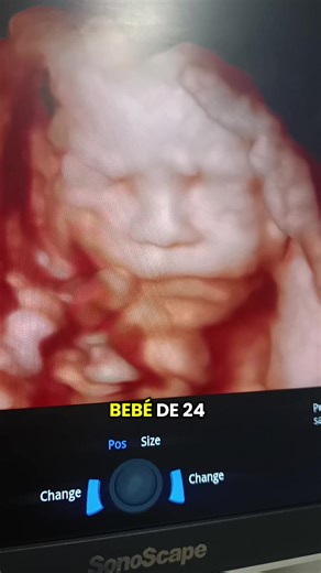 2D vs 5D Ultrasound: Exploring the Differences