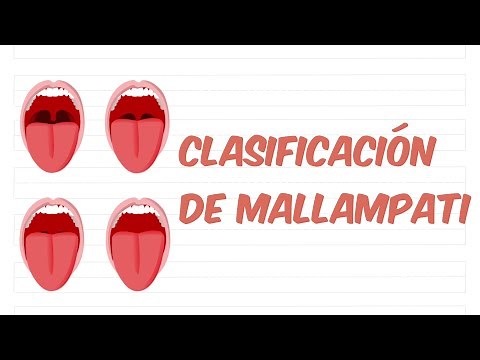 Clasificación de Mallampati en UN MINUTO ⏱