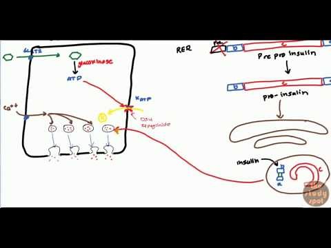 Diabetes Mellitus Type 2 for USMLE Step 1 and USMLE Step 2