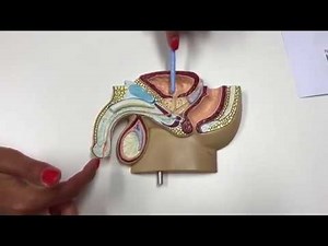 Rezum Procedure and SPC (catheter)
