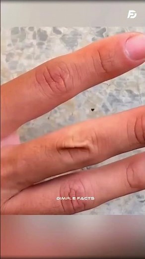 Pinch Your Skin & Test for Dehydration! 💧🚨