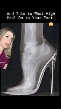 Are high heels destroying your feet?!