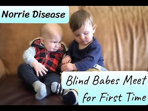 BLIND BABIES MEET FOR FIRST TIME: Norrie Disease is rare which makes their friendship one of a kind.