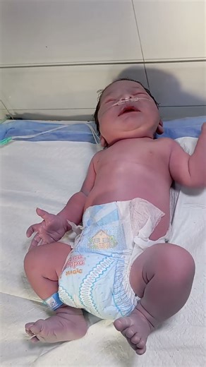 I D M baby and there waghit are 4. 9 kg baby was so distressed and and mild graunting