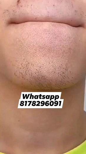 1.1M views · 4K reactions | WHATSAPP- 8178296091 Just Rs.299/-...