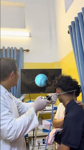 Deep Ear Cleaning Miracle 👂 | Huge Wax Plug Removed Safely #entclinic #health #viral