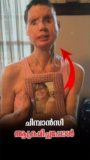 ചിമ്പാൻസി ചെയ്തത് കണ്ടോ.. 😱‼️|#shorts