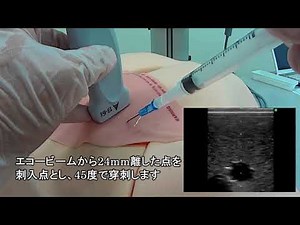 エコーガイド下CVC＿短軸像swing scan法＿右鎖骨下＿腋窩静脈穿刺＿穿刺シミュレータ