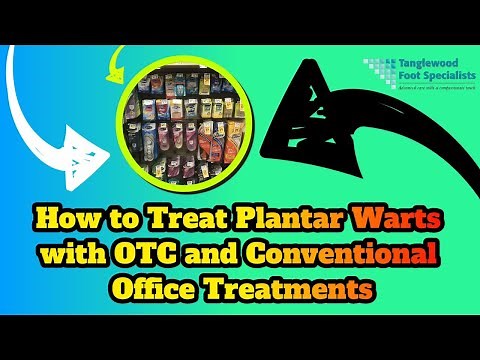 How to Treat Plantar Warts with OTC and Conventional Office Treatments