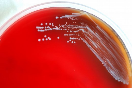 Brucella Bacteria - Classification, Characteristics, Causes/Treatment