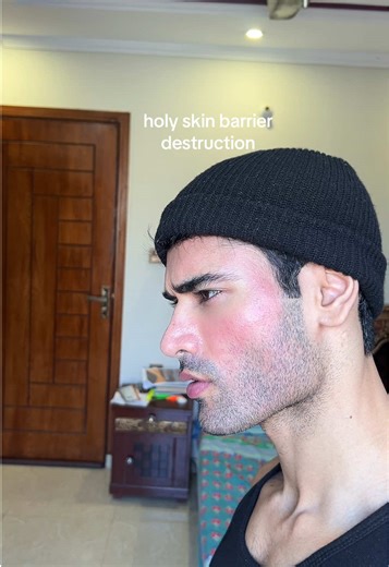 jk my skin barrier is fine. Microneedling creates controlled micro injuries that signal your skin to repair itself, build more collagen, and improve texture over time. Done right with proper spacing it improves your skin tremendously. Pairing it with a retinoid after can boost results even more. Those micro channels help penetration, so the retinoid works deeper to speed up collagen signaling and skin turnover.