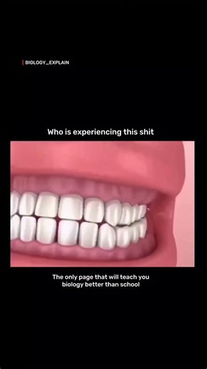 medical / biology explain on Instagram: "Ever wonder why wisdom teeth cause so much trouble? 🦷 When there isn’t enough room in the jaw, these late-bloomers can become “impacted,” growing at an angle and pushing against your other teeth. This doesn’t just cause pain-it can lead to crowding, cysts, and even damage to healthy molars. If you’re feeling that pressure in the back of your jaw, it might be time for an X-ray! . . Dm for credit or removal. Fir educational purposes only..... . . #explore 