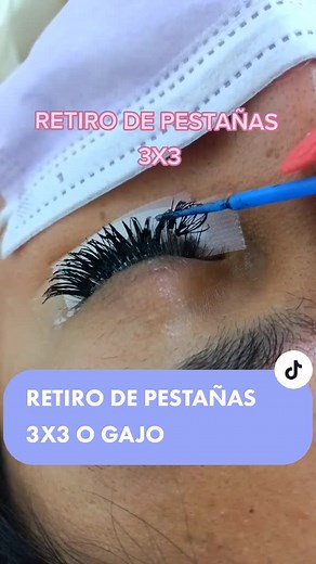 Retiro de Pestañas 3x3: Proceso y Resultados