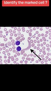 Identify the Marked Cell in Hematology Samples
