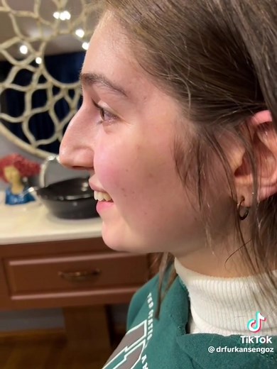 Roman Hooked nose is more authentic and attractive. No need to get irish/anglo nose. #nosejob #romannose #replyvideo #ethnicnose #rhinoplasty