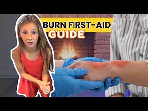 Burn First Aid Guide | How to Treat 1st, 2nd, and 3rd Degree Burns