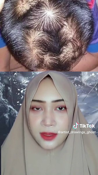Arti Unyeng-Unyeng di Kepala dan Karakteristiknya
