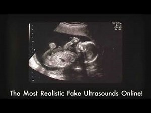 Fake Ultrasounds Online