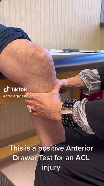 Anterior Drawer Test for ACL Injury: How to Perform and Interpret Results