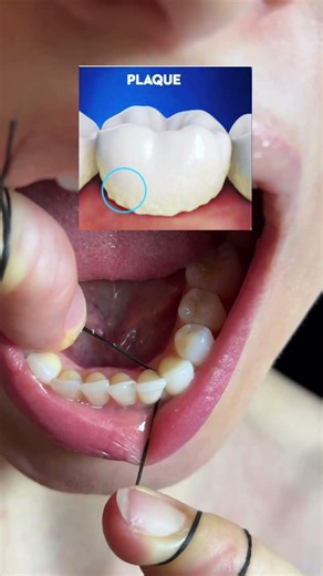 Correct way of flossing #tooth #dentist #food #floss #cleaning