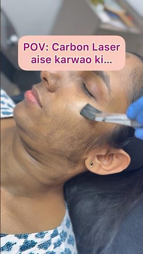 Carbon laser treatment | Laser face treatment | Carbon facial