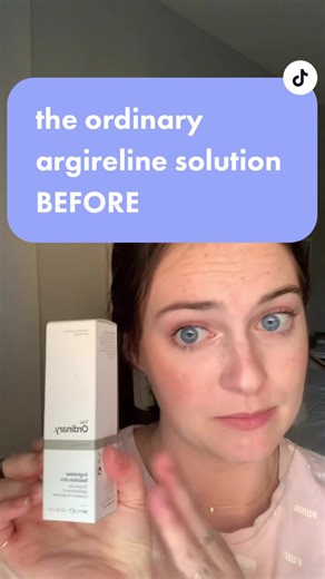 Unlocking the Power of Argireline: Before and After Results Revealed