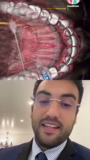 SEE HOW DENTIST ANESTHESIA WORKS