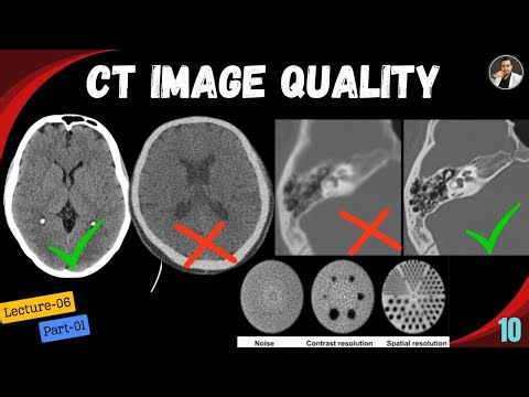 Image Quality in CT Scan-Lecture-06(Part-01)-Tutorial-10| Scanning Parameters|Slice Thickness| Pitch